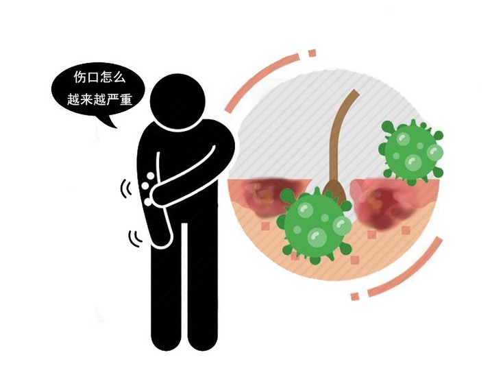 神经末梢|糖尿病患者谨防“烂脚”,建议做好3点,避免患上糖尿病足