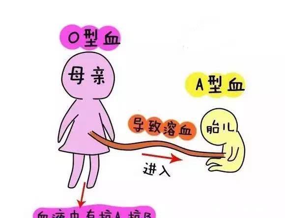 胆红素|夫妻血型不合对宝宝有什么影响呢?