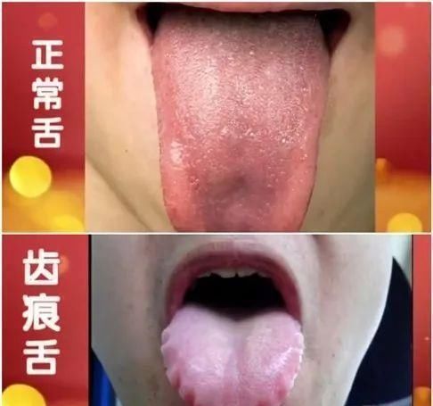 益脾饼|脾胃差，鸡内金与它们搭配，经常喝一点，健脾养胃，清除脏腑垃圾