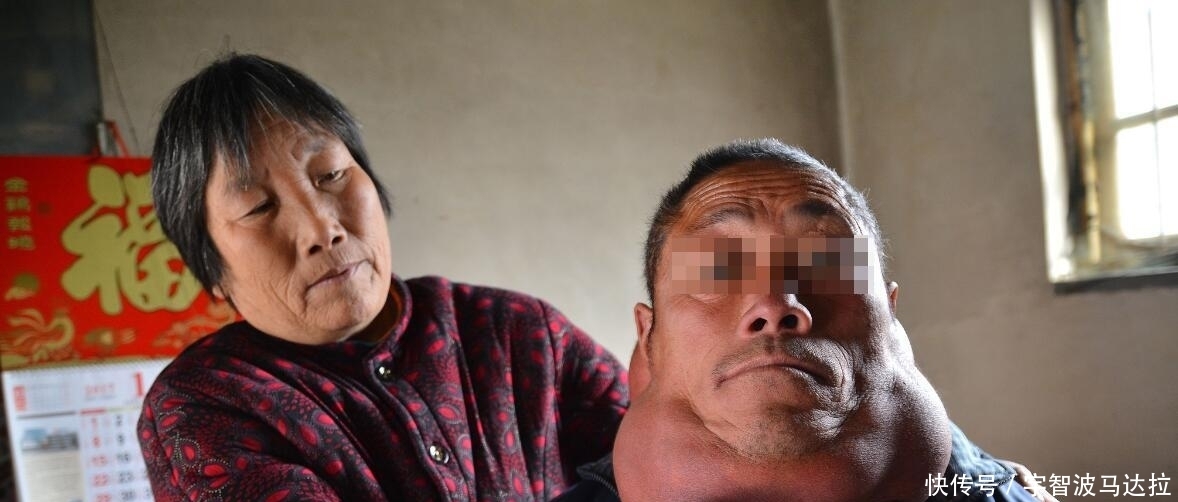 被称为肠道蠕动的加速器的1种菜,降脂、减肥,昨天你刚吃过