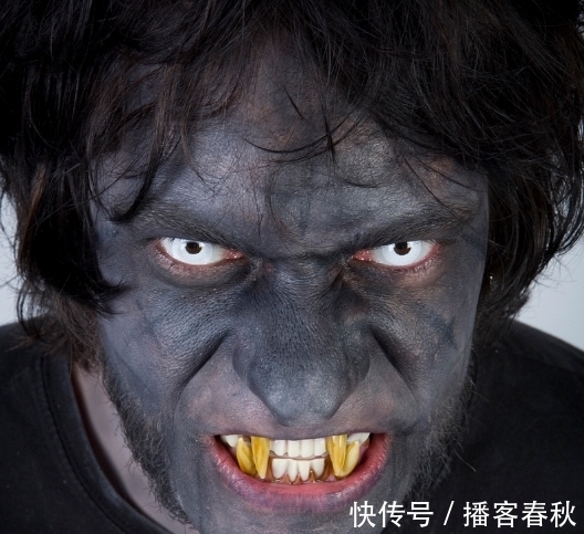 怪物|七岁男孩嘴中有526颗牙齿,医生花费5小时取出,和怪物没区别