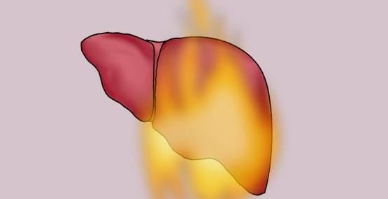 食物|心火、胃火、肝火、肺火、肾火,各有不同,专家教你来灭火