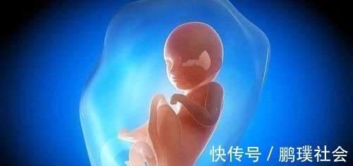 脐带|6个月脐带扭转导致胎停,是什么原因造成?以后怀孕要怎么注意?