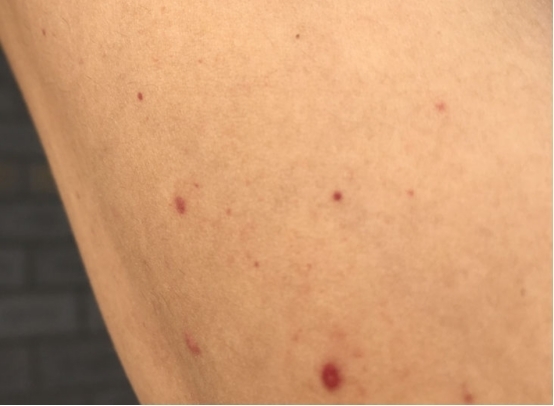 老陈|吃一次等于吃6斤枸杞,呼吁肝不好的不妨常吃,或可排尽肝毒