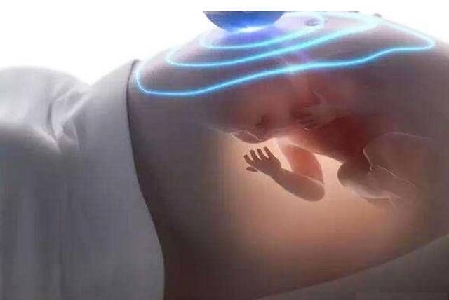 宝宝|先破水的是男孩？医生：和性别无关，暗示了胎儿的发育好坏