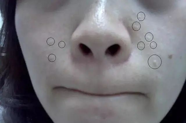 脸部|床上有没有螨虫,身体4个信号告诉你,除螨土办法,赶走床上螨虫