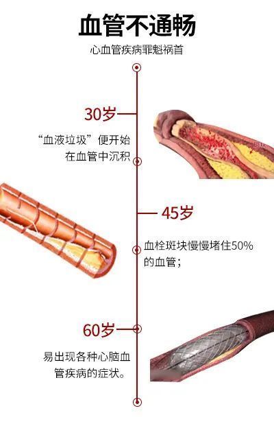 清道夫|天然血管清道夫，老中医早餐吃它50年，血管干净，心脏如小年轻