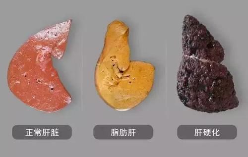 白心火龍果|提醒：肝不好的人，這幾種水果可以多吃點，或能幫助修復肝功能