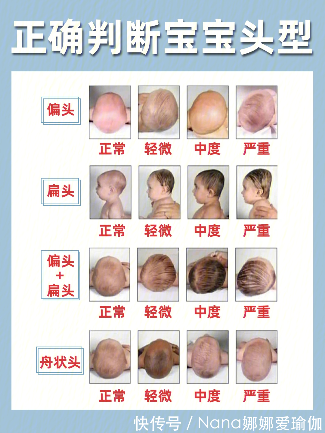 睡姿|宝宝睡圆头矫正头型，保姆级教程来了！