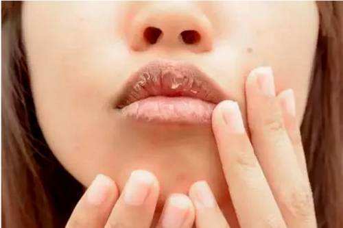 嘴巴|女人嘴巴上若有5个表现，多半是妇科病缠身，不妨了解下