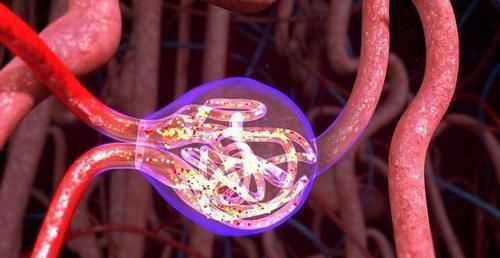 症状表现|尿毒症早期会有哪些症状？