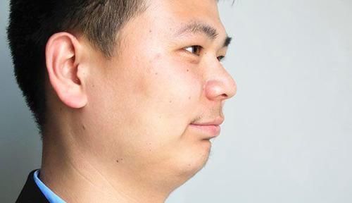 衰老|男性刚到40岁,就衰老了,通常有哪些表现缓解早衰,做什么好