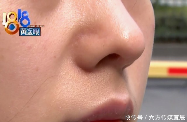 女子|女子花4万多做整形,术后鼻子凹陷讨说法,院长:你以后别照镜子