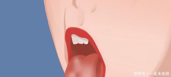 脾虚的人，身体可能会有这几个表现，如果你也有，需要补脾了！