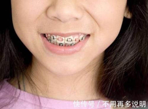 b超|为何多数医生不建议做核磁共振？或许很多人还不知道，了解一下