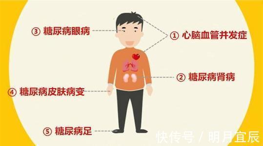 稳定|2型糖尿病患者的最佳零食,稳定血糖,降低并发症风险