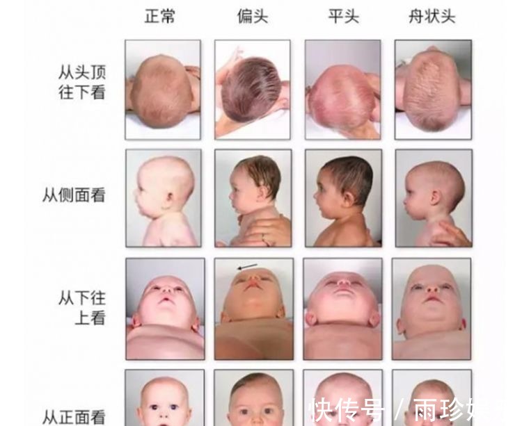 大头儿子|这种“头型”的孩子,自身携带“高个”基因,中了的父母偷着乐吧