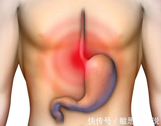 丁香|胃不好鼻先知,若鼻子没有4个异常,恭喜你,说明胃还算健康!