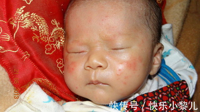 医院|新生儿的六种“异常”症状,会自然变好,妈妈别惊慌更无需上医院