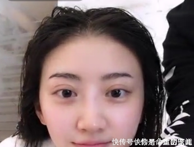 割双眼皮和天生双眼皮的人有什么不同,现在知道还不晚