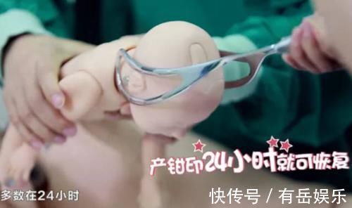 产钳|6个月宝宝产钳印明显,奶奶找医生“算账”,医生的话让她脸红