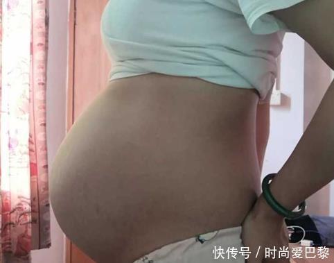 形体|四维彩超通过后,胎儿为何会畸形建议提前了解