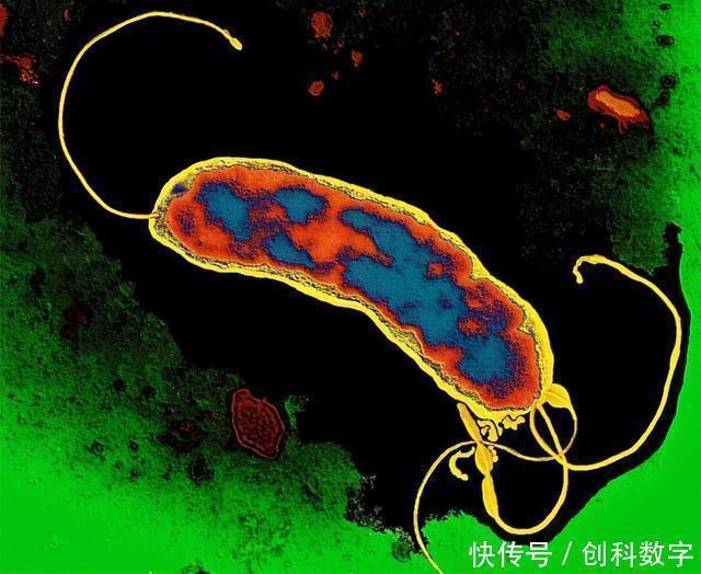 胃病“凶手”幽门螺杆菌逮着了,牢记好1个方法,胃越来越强壮
