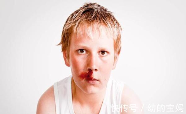 动作|3岁男孩鼻出血因一个错误动作去世,医生提醒:应该这样正确应对