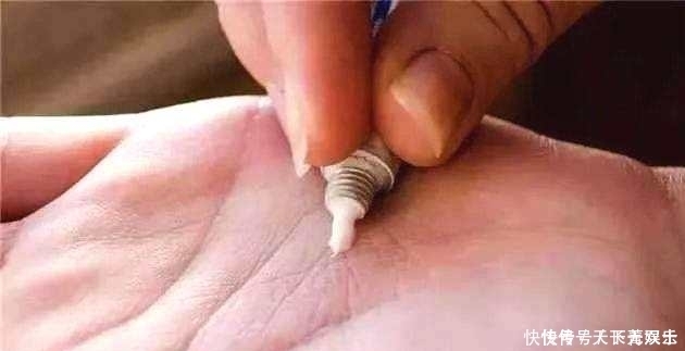 你家有2元一支红霉素软膏吗？很多人还不懂，越早告诉家里人越好
