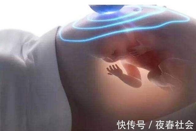 医生|先破水的是男孩？医生：和性别无关，暗示了胎儿的发育好坏