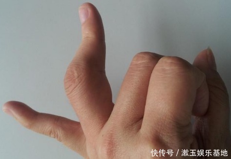 痛风|老中医:1个鸡蛋+玉米,两周尿酸降到280,“痛风”也赶紧跑了