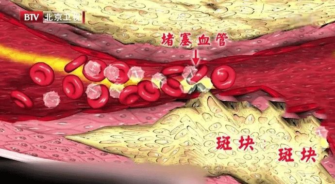 豆浆|大豆是调血脂的“高手”，但吃错了血脂可能更高！帮你认清豆制品的“真面目”