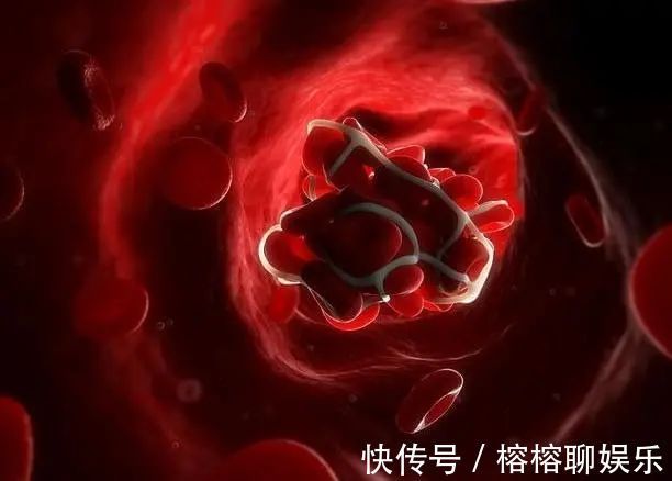 下肢|血栓形成后,腿脚容易出现4个异常,若一个没有,血管还算通畅