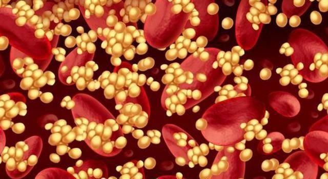 降甘油三酯|甘油三酯大于17界点,暗示血脂超标,3个小妙招快、狠、准