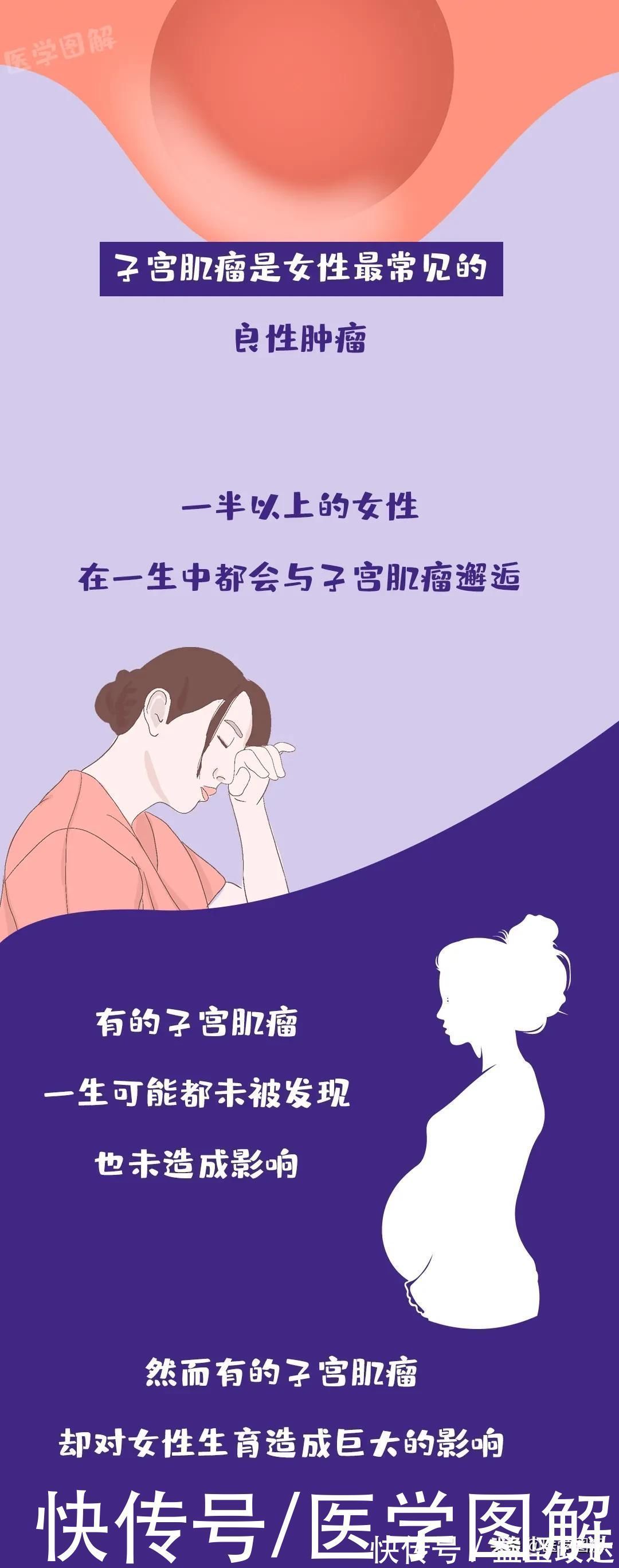 医学|为什么有的子宫肌瘤没有事,有的就会让人不孕不育丨医学图解
