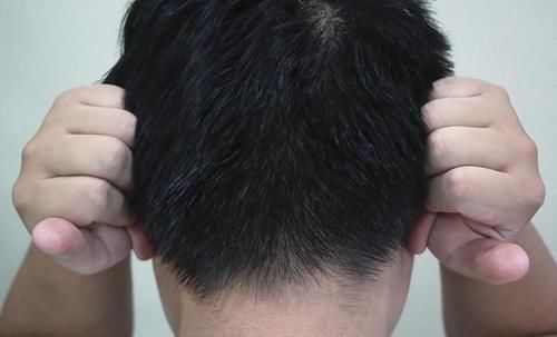 尿频尿急|男人老没老,身上的表现骗不了人,占3个以上,该服老了