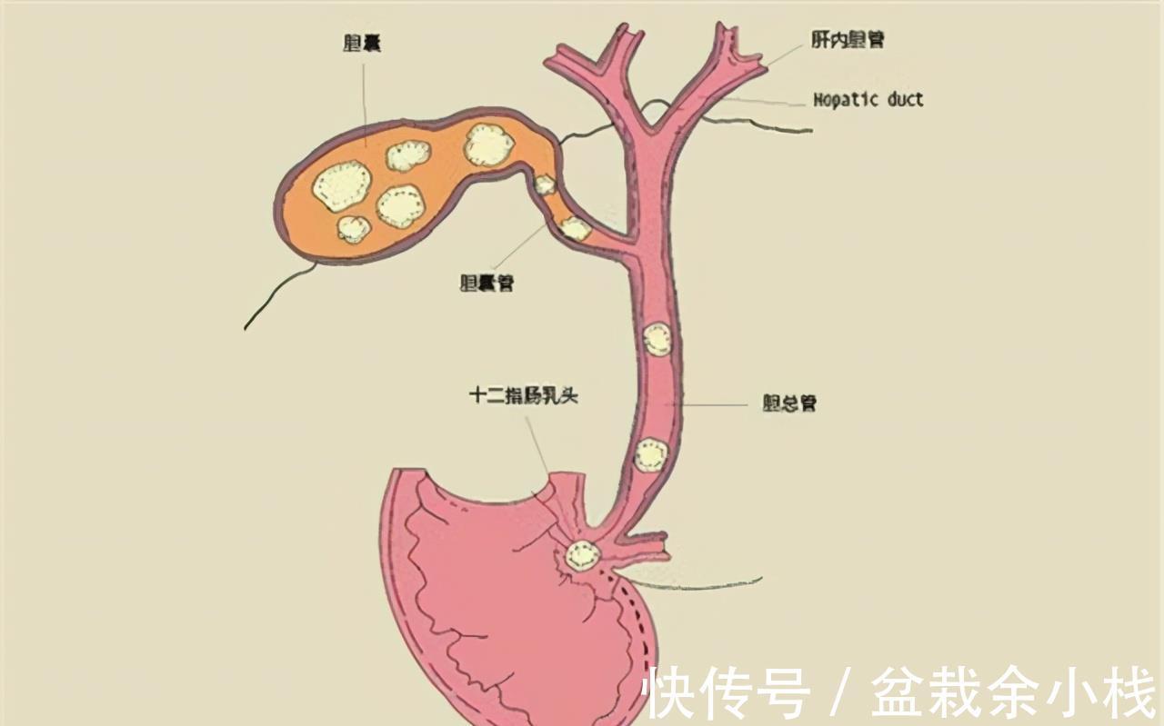 甘油三酯|甘油三酯高了就要吃药？医生：错了，达到一定的数值才要吃降脂药