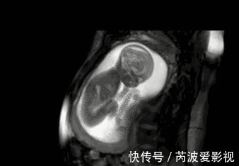 排畸|胎儿在肚里传递的4个信号，孕妈接收到几个？越多说明宝宝越聪明