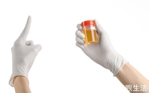 症状|医生提示:身体出现6个症状,十有八九是肝硬化,占一个也要CT