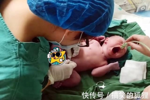 母乳|新生儿出生后,被护士抱走的10分钟经历了啥?这些处置一步不能少