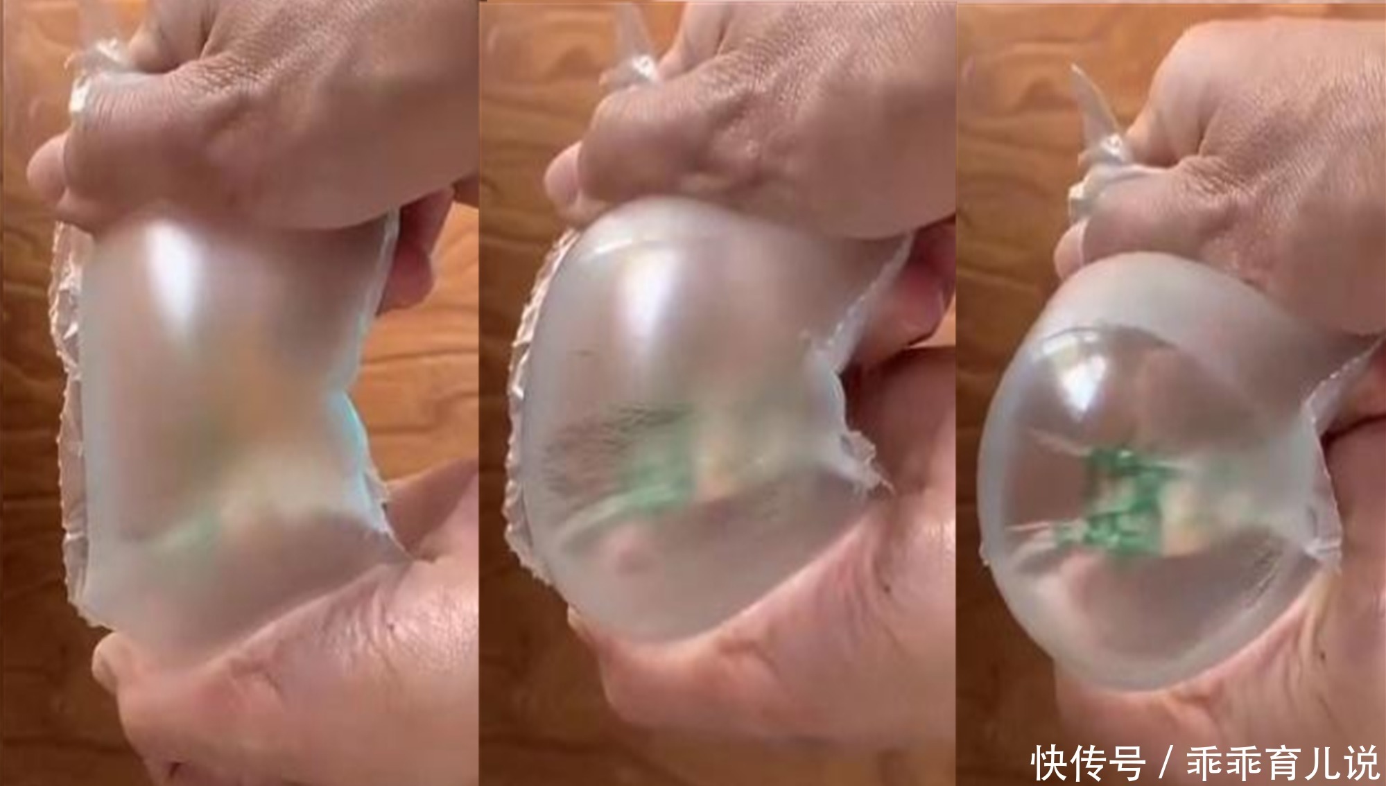 演绎|怀孕时,妊娠纹是怎么长出来的?医生的演绎很形象,一般人不知道