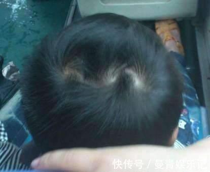 毛发|为什么有的孩子头上有“2个旋”?代表什么意思,父母要知道