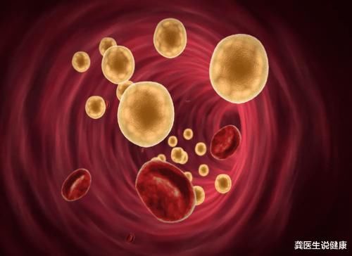 胆固醇|退休院士亲身经历：甘油三酯3.9，戒掉“2物”后，半年时间血脂恢复正常