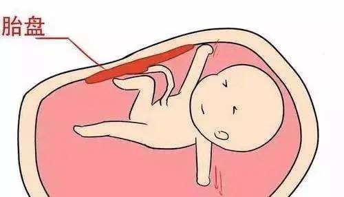 大宝|“二胎是男孩还是女孩,看大宝就知道”,老一辈的断言可靠吗