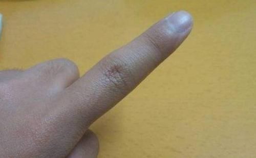 结节|患有肺结节的人,能吃豆制品吗?提醒:不妨多吃2物,或有所改善