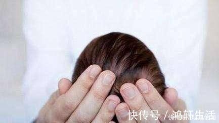 欣欣|儿科医生囟门是宝宝健康晴雨表,4项误区,6种异常要牢记