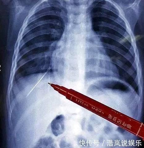 学校|6岁女童胸口不让人碰,有天学校体检,老师让父母道歉