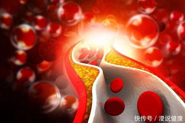 中老年人|保护心血管并不难,不妨从这几个方面开始,相信你也能做到