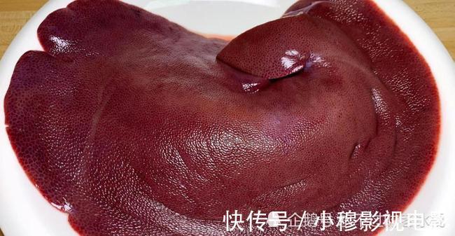 医生|53岁阿姨因常吃一“零嘴”,肝或慢慢恢复健康,医生:值得学习