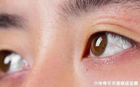 近视|近视却不戴眼镜，八成会出现以下“3种后果”，网友：为啥不早说